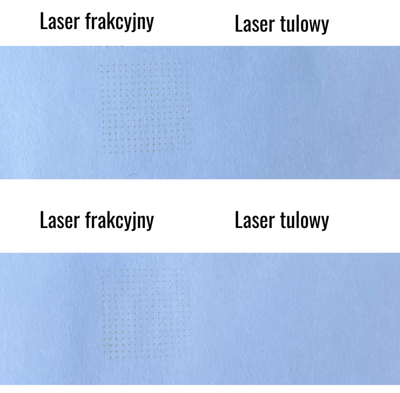 Eksperyment z kartkami i laserami