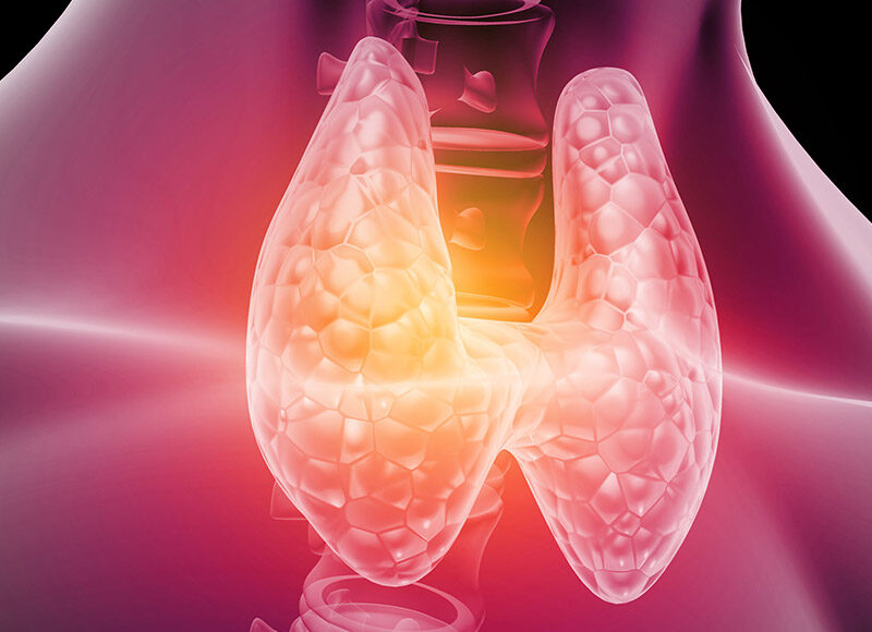 hashimoto a zabiegi medycyny estetycznej